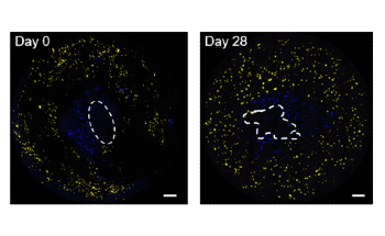 New Bioink Allows 3D-Bioprinting of Human-Sized Airways