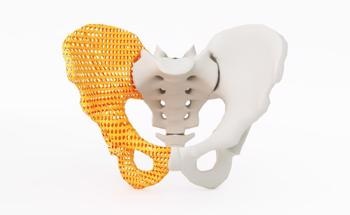 Titania Nanotubes Synthesized on 3D-Printed Ti-6Al-4V Surface for Drug Delivery