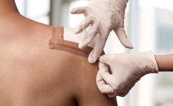 A Novel Powder for Rapid Wound Healing