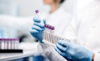 Scientists Develop Novel Cobalt-Based Catalyst with Higher Chirality