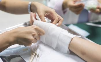 Electrospun Nanofibers for Effective Skin Burn Treatment