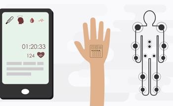 Trends in Flexible Wearable Sensors for Arrhythmia Diagnosis