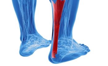 Could Biodegradable Polymers Repair Achilles Tendon Injuries?