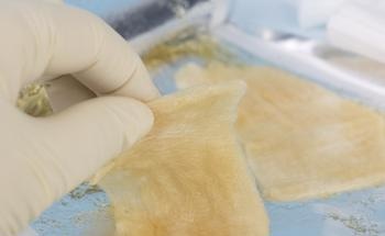 Biocompatible Chitosan-Based Hydrogel with Antimicrobial Properties