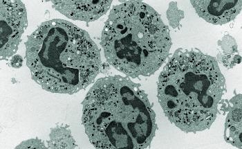New Computer Simulation Models the Electrostatic Self-Organization of Zwitterionic Nanoparticles