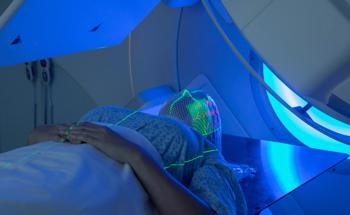 What is the Effect of Radiotherapy on Teeth?
