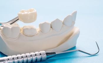 How is Polyetheretherketone Used in Dentistry?