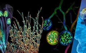 The Art of Science: EVIDENT Launches Expanded Global Image of the Year Contest