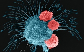 Highlighting the Treatment of Breast Cancer Tumors via 3D Printing