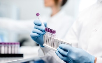 Researchers Develop Electrochemical Approach for Recycling Homogenous Catalysts