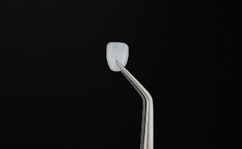 Boston Micro Fabrication to Market World’s Thinnest Cosmetic Dental Veneer