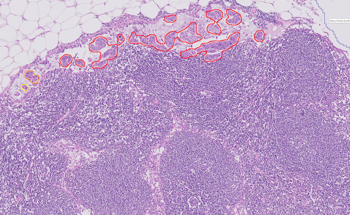 EVIDENT Announces Alliance to Automate Digital Pathology Workflows