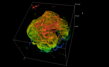 EVIDENT, 89 North and CrestOptics Collaborate to Advance Live-Cell Imaging