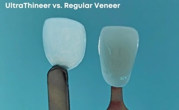BMF Receives FDA 510(k) Clearance for UltraThineer Cosmetic Veneer Material
