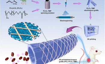 3D Printing Technology Advances Vascular Graft Design