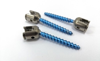 In Vivo Wear and Corrosion of Titanium Alloy Spinal Implants