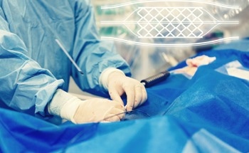 Tailoring Silk-Based Covering Material for Vascular Tissue Engineering
