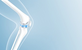 Dose-Dependent In Vitro Osteogenic Activity on Strontium-Decorated Polyetheretherketone