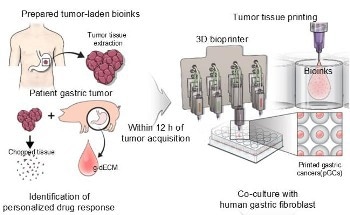 New 3D Model for Gastric Cancer Research