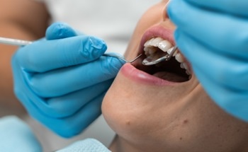 Laser Technology May Improve Zirconia Bond Strength in Dentistry