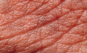 Scientists Have Created Artificial Skin that Can Sense, Heal and Adapt