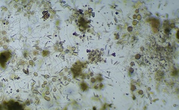 Aged Bacteria Could Make Bio-Cementation More Reliable