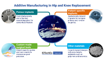 How 3D Printing is Reshaping the Future of Hip and Knee Replacements