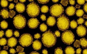 Simple Cell Membranes Mimic Brain Learning Without Complex Neural Networks