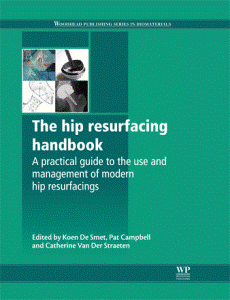 The Hip Resurfacing Handbook