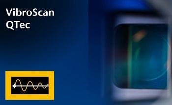 A New Technology for Full-Field Optical Vibration Measurement