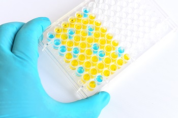 The Use of SPRi for the Characterization of Multiple Ligands: Examples of Alzheimer's Disease Investigation and Circulating Antibodies Bioassay Optimization