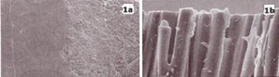 AZoM - Metals, Ceramics, Polymers and Composites : Refractories - CO2 Laser Surface Treatment of Refractories for Improved Performance