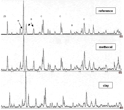 AZoJomo - The AZO Journal  of Materials Online - Composition 1 sintered to 1450°C during 18 h with addition of methocel and clay, load 13350 N, (B-badeleyite, C-corundum, Q-quartz, ZS-zircon, M-mullite).