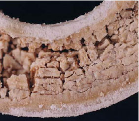 The bearing showed cracking and loss of material integrity, which was characteristic of severe chemical attack.