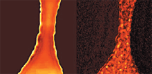 Topography (left) and tunnelling (right) current images of an 8.5nm thick tunnel oxide (SiO2) measured at a sample bias of 10V. 2£gm scans, 200 fA current scale.