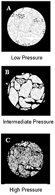 Mercury intrusion into pore space as pressure increases; black areas indicate mercury.A. Mercury envelops the mass.B. Mercury fills the interparticle voids.C. Mercury penetrates into the pores of the individual particles.