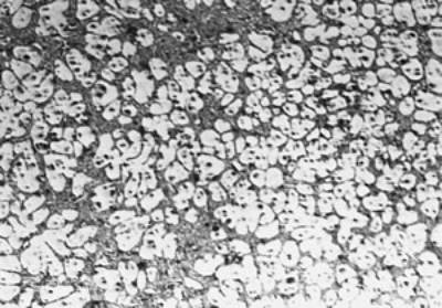 AZoJomo - AZoM Journal of Materials Online - Microstructures of AC4CH alloy specimens Ex. 4 insertion at 888K with cooling rate of 12.7K/min.