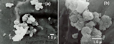 AZoJomo - The AZO Journal of Materials Online - SEM micrographs corresponding to: (a) BAS and (b) sodium dawsonite obtained at pH 10.6.