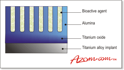 AZoM - Metals, Ceramics, Polymer and Composites : Schamtic of a Porous Coating for Improved Implant Life of Total Hip Replacements and other implants